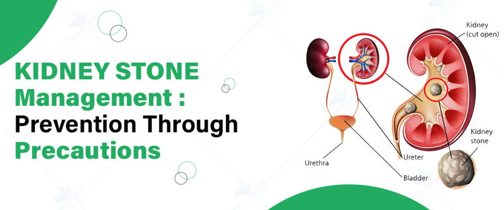 prevent kidney stone