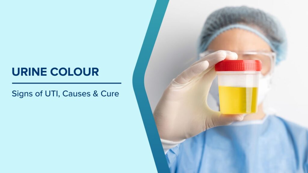 Urine Color Symbol